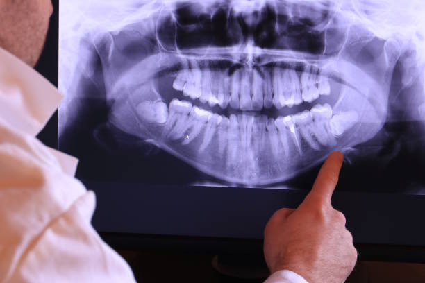 Best Emergency Dentist for Knocked-Out Tooth in Newstle, CA