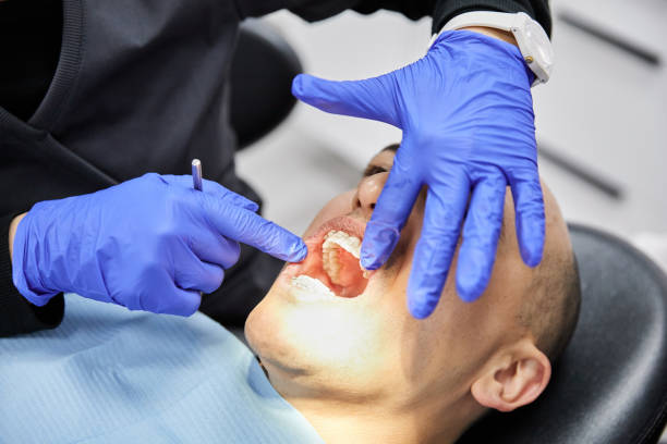 Best Emergency Root Canal Treatment in Newstle, CA